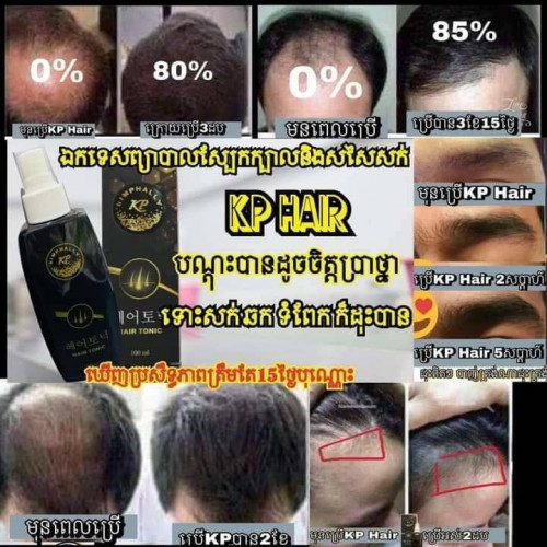 ឯកទេសបណ្ដុះសក់