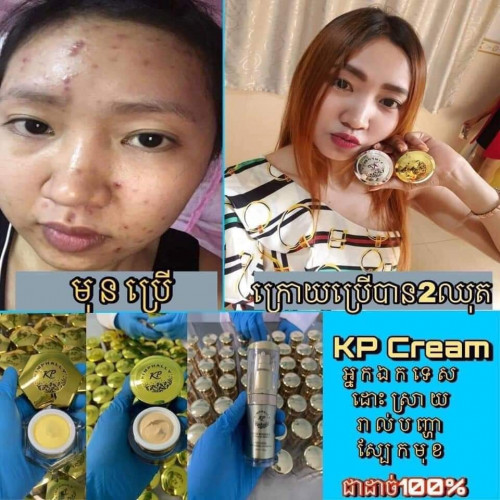 ព្យាបាលមុខមុន មុខជាំ