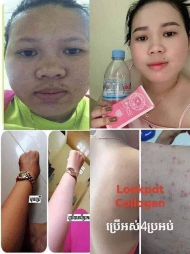 Lookpat collagen