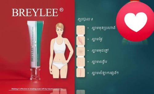 លាងស្តុក Breylee បំបាត់ស្នាមផ្លែ Acne scare removal