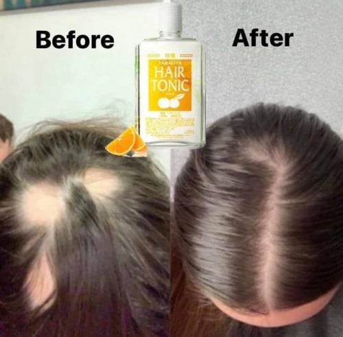 ទឹកបណ្ដុះសក់ ផលិតផលរបស់ប្រទេសជប៉ុន