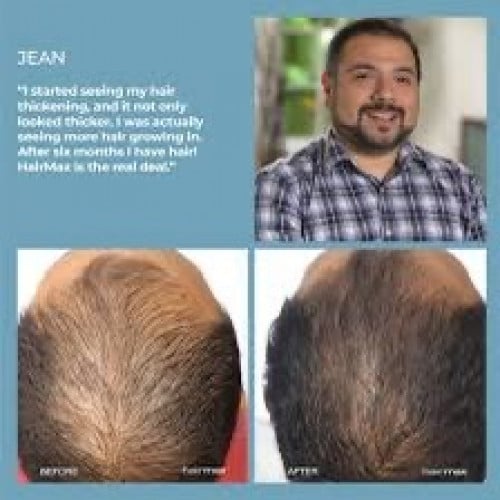 Hairmax 272 Cap for Sale (Hair Regrow tool)