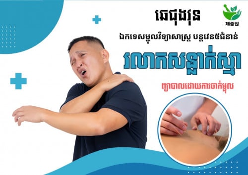 ព្យាបាលដោយចាក់ម្ជុកជំងឺរលាកសន្លាក់ស្មា