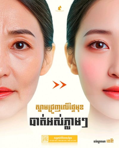 Filler បំបាត់ស្នាមជ្រីវជ្រួញអ្នកភ្លាមៗ