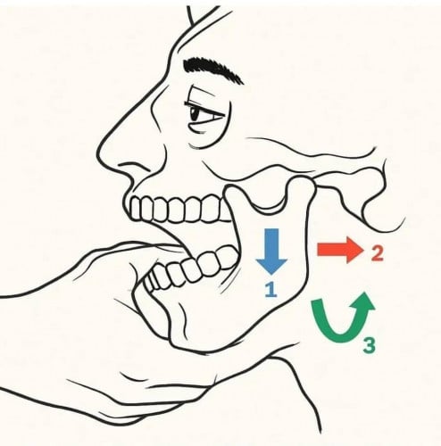 ជ្រេីសរេីស​ជាងធ្មេញ