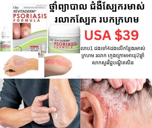 ថ្នាំព្យាបាលជំងឺស្បែករមាស់ រលាកស្បែក របកស្បែកក្រហម