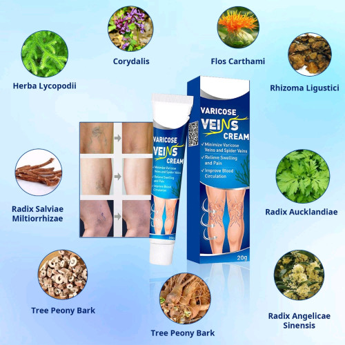Varicose Veins លាបសសៃហើមប៉ោង
