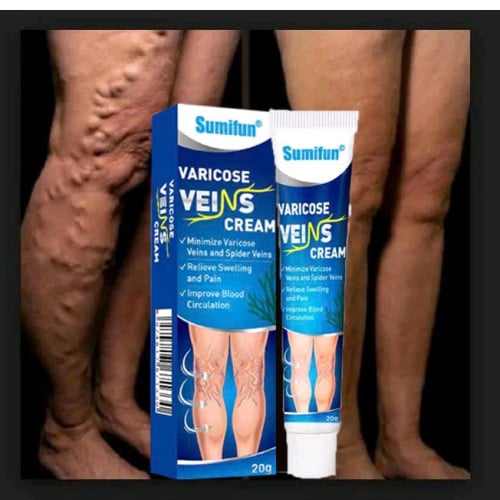 Varicose Veins លាបសសៃហើមប៉ោង
