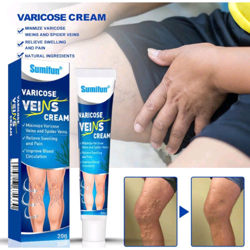 Varicose Veins លាបសសៃហើមប៉ោង