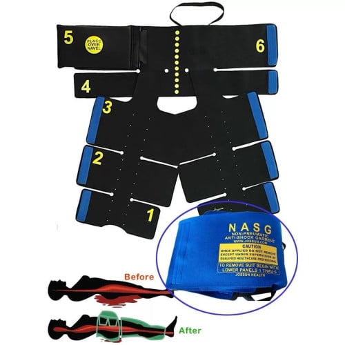 Non-pneumatic Anti-Shock Garment (NASG)
