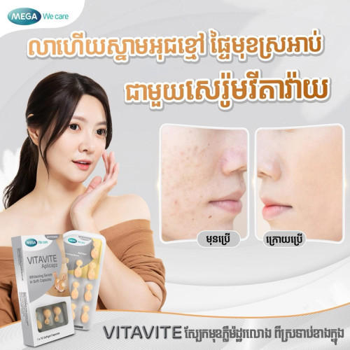 Vitamin ព្យាបាល​ស្បែក​មុខ​ ​អុជខ្មៅ​ ស្នាម​ជាំ​ ស្នាម​មុន​ ​ស្បែក​មុខ​សរ​រលោង​​