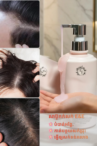 សាប៊ូកក់សក់ 𝐄&𝐄  បំបាត់អង្គែគ្មានសល់