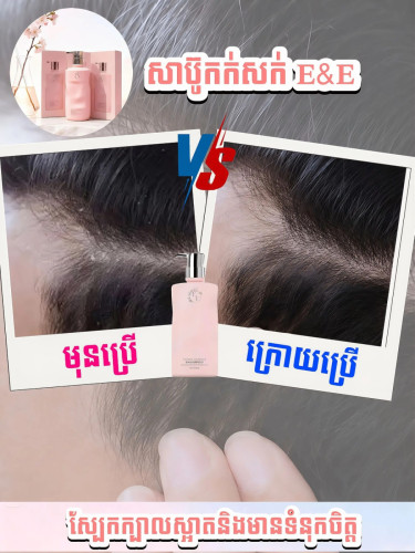 សាប៊ូកក់សក់ 𝐄&𝐄  បំបាត់អង្គែគ្មានសល់