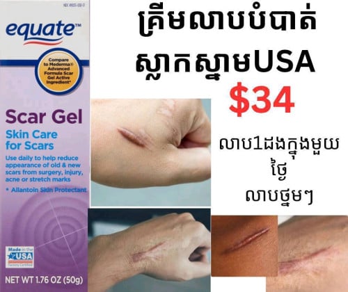 គ្រីមលាបបំបាត់ស្នាម Equate Scar Gel (50g)