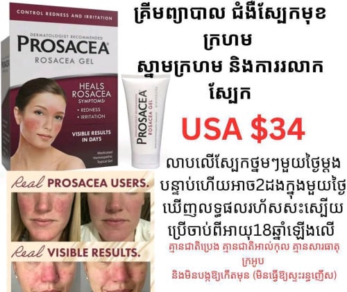 គ្រីមព្យាបាលស្បែកមុខ Prosacea Rosacea Gel