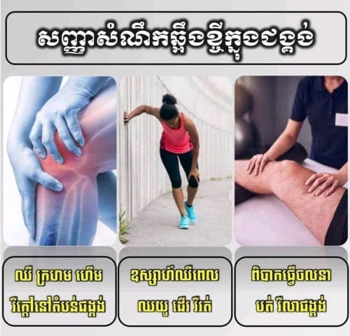 យ៉ុងលាងផ្លើស